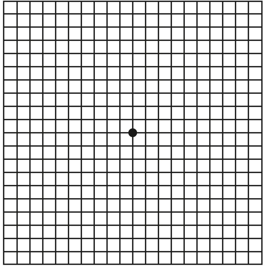 Eigendiagnose Makuladegeneration durch den Amsler-Test: Normales Sehen